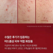 Medicube - Red Toner 2.0, 100ml Medicube