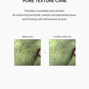SKIN1004 - Madagascar Centella Niacinamide 10 Boosting Shot Ampoule, 30ml SKIN1004