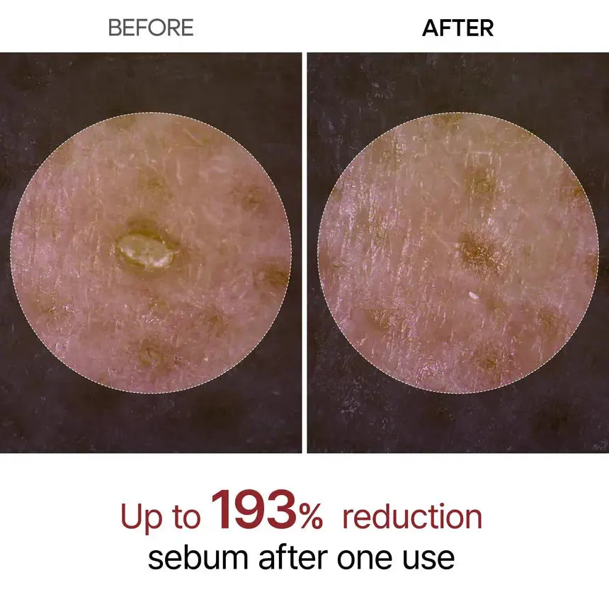 Dr.Melaxin – Peel Shot Exfoliant White Rice Ampoule, 80ml Dr.Melaxin