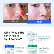 Medicube - Zero Pore Pad 2.0 70 Pcs Medicube