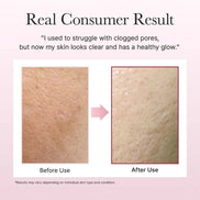 Arencia – Fresh Rosehip Mochi Cleanser, 120g Arencia