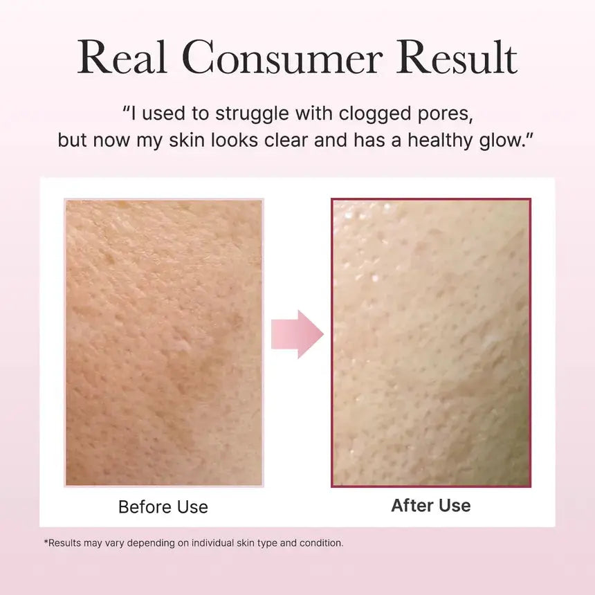 Arencia – Fresh Rosehip Mochi Cleanser, 120g Arencia