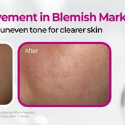 Dr.Melaxin – Cemenrete Picotonic Shot Pigmentation Ampoule, 30ml Dr.Melaxin