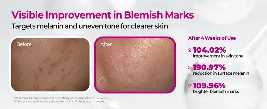Dr.Melaxin – Cemenrete Picotonic Shot Pigmentation Ampoule, 30ml Dr.Melaxin