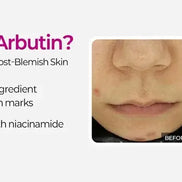 Dr.Melaxin – Cemenrete Picotonic Shot Pigmentation Ampoule, 30ml Dr.Melaxin