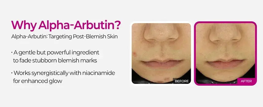 Dr.Melaxin – Cemenrete Picotonic Shot Pigmentation Ampoule, 30ml Dr.Melaxin